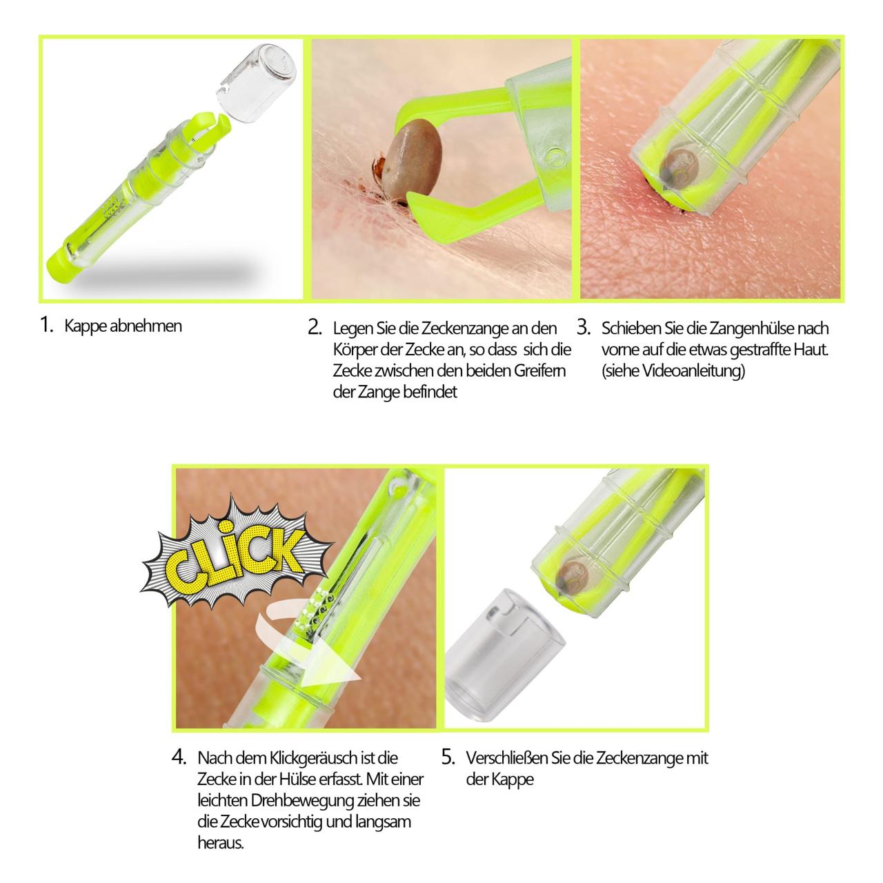 ZECKENSPECHT®
